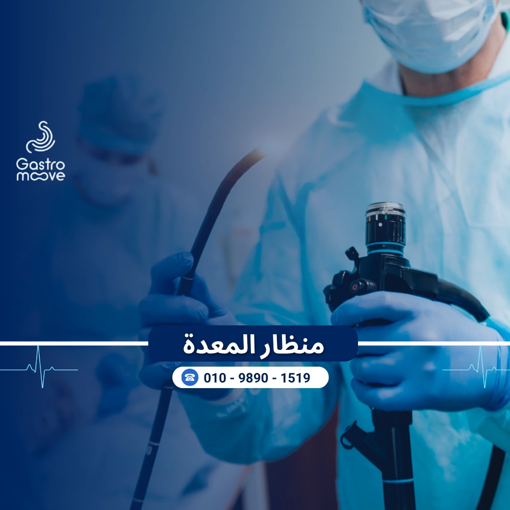 عملية منظار المعدة