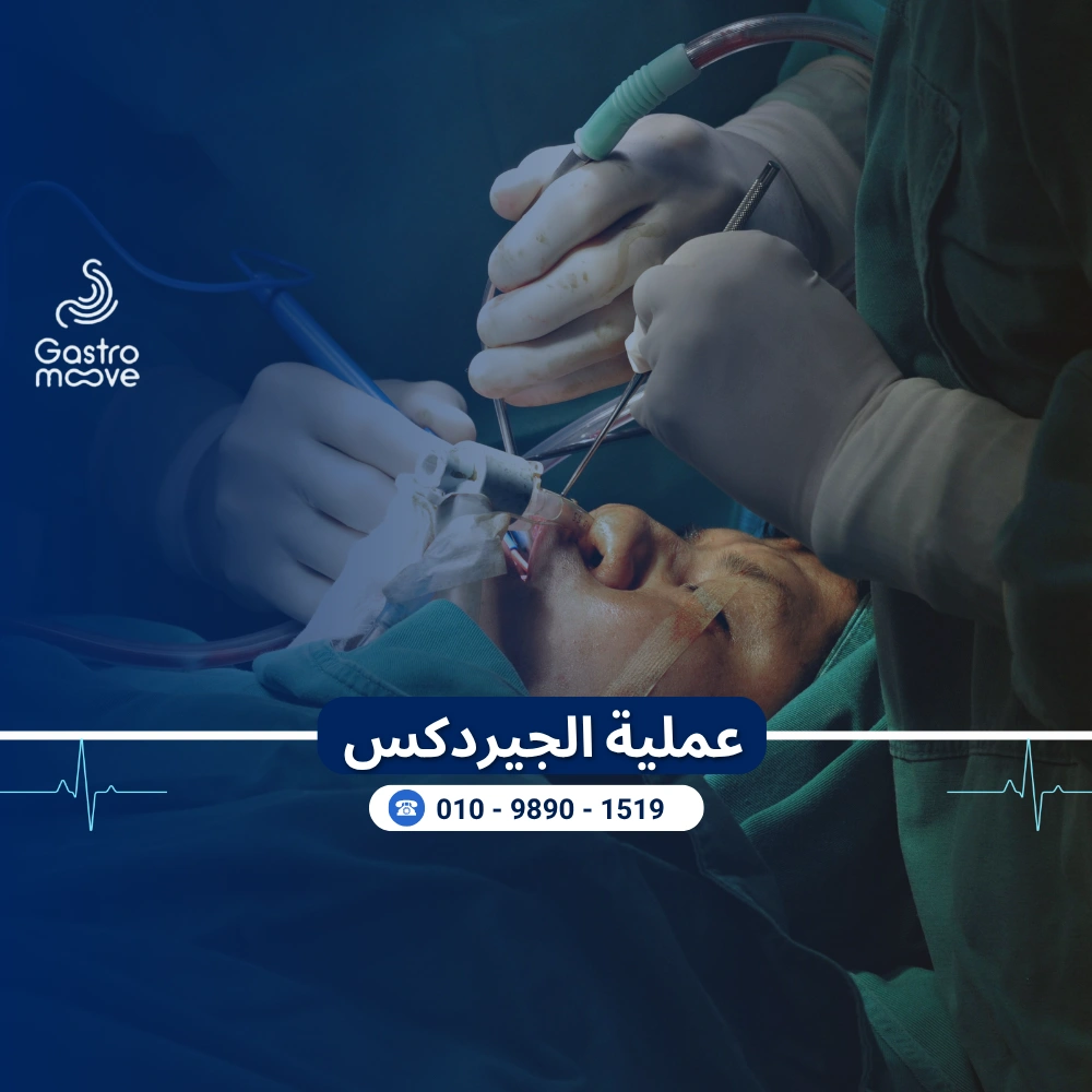 عملية جيردكس GERDX