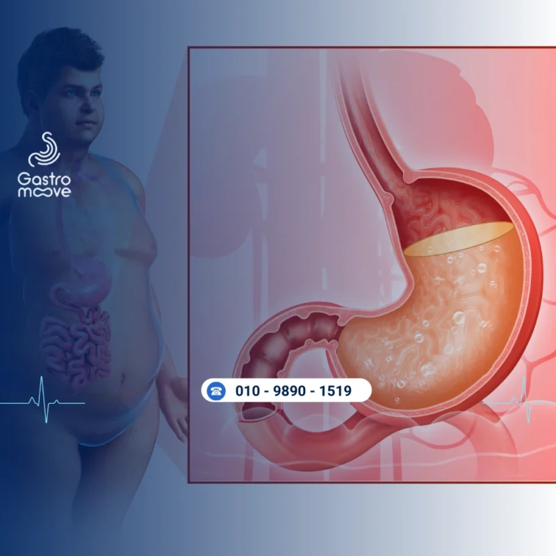 قياس حموضة المرئ