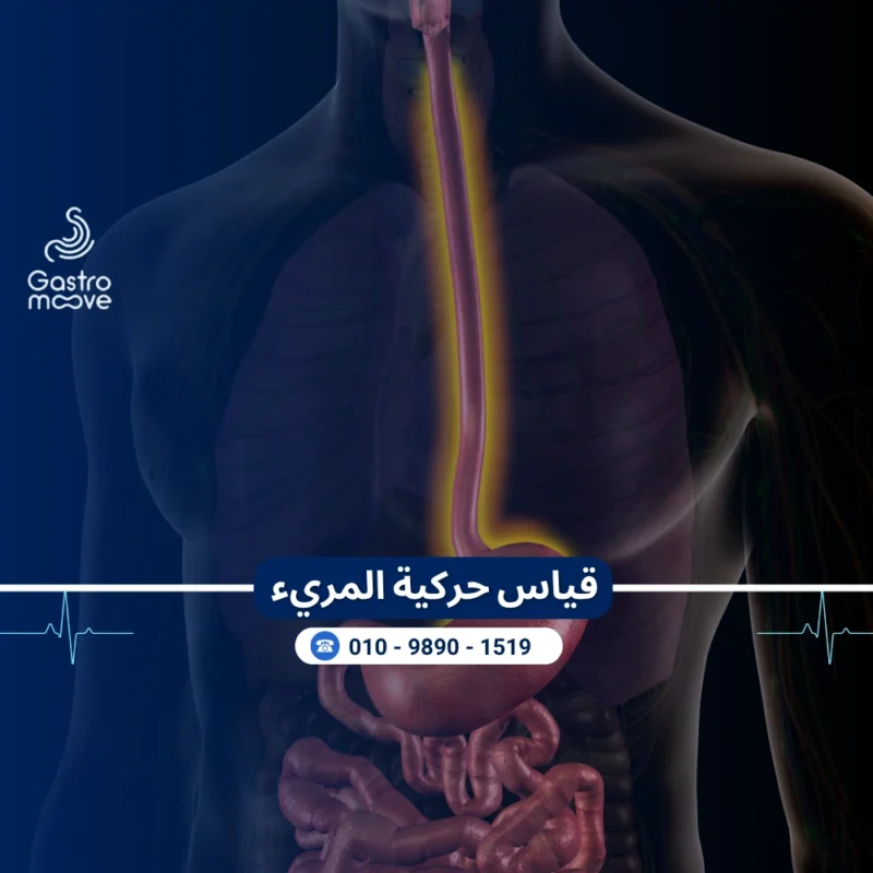 قياس حركية المريء