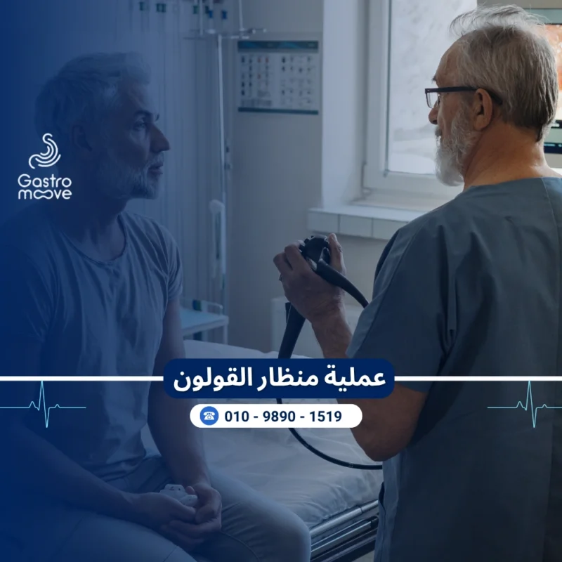 عملية منظار القولون