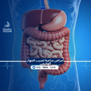الامراض المناعية التي تصيب الجهاز الهضمي