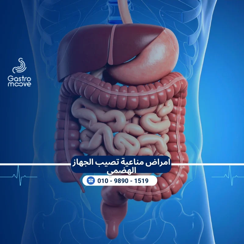 الامراض المناعية التي تصيب الجهاز الهضمي