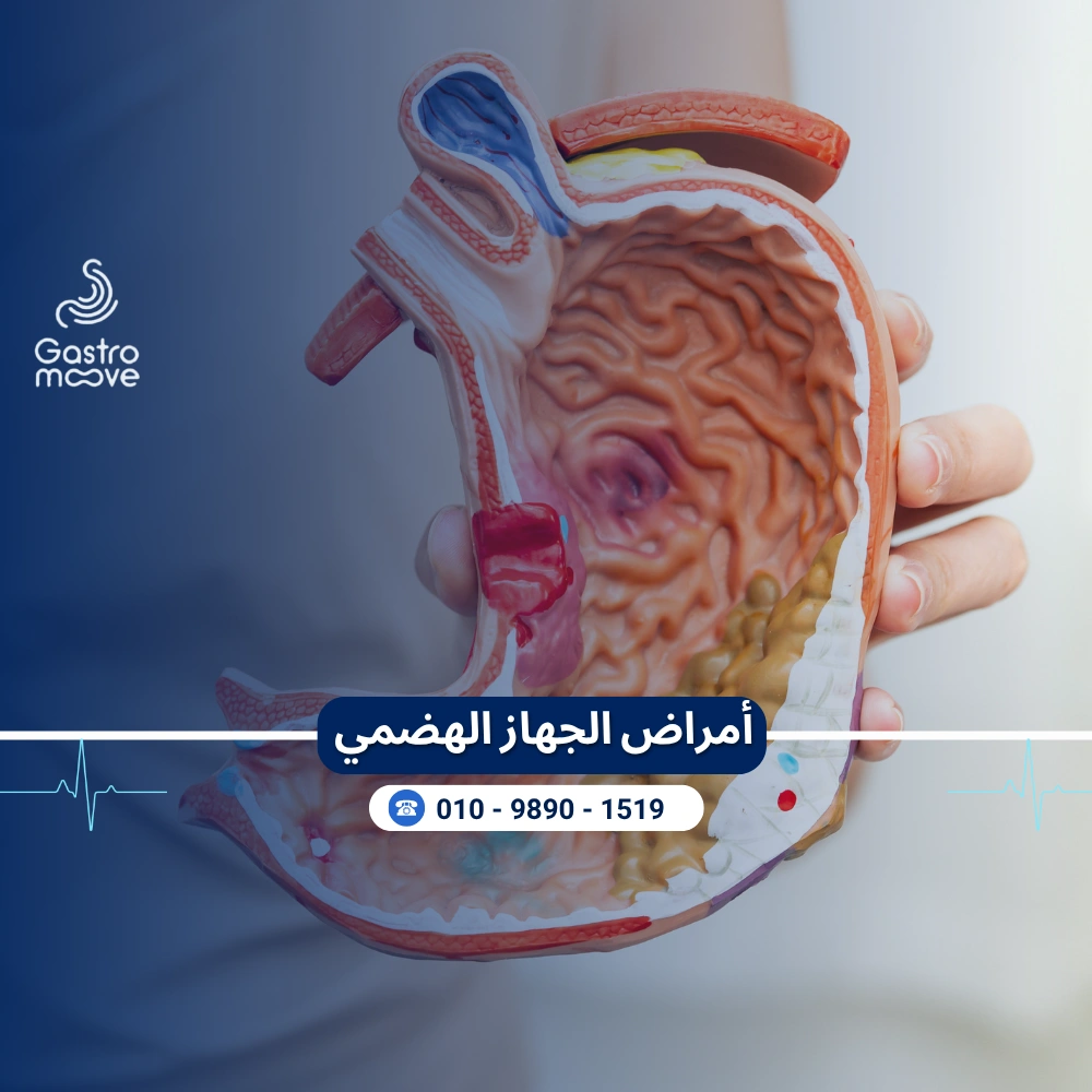 أمراض الجهاز الهضمي