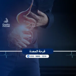 قرحة المعدة