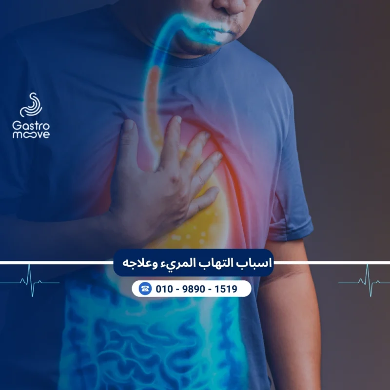 اسباب التهاب المريء و علاجه