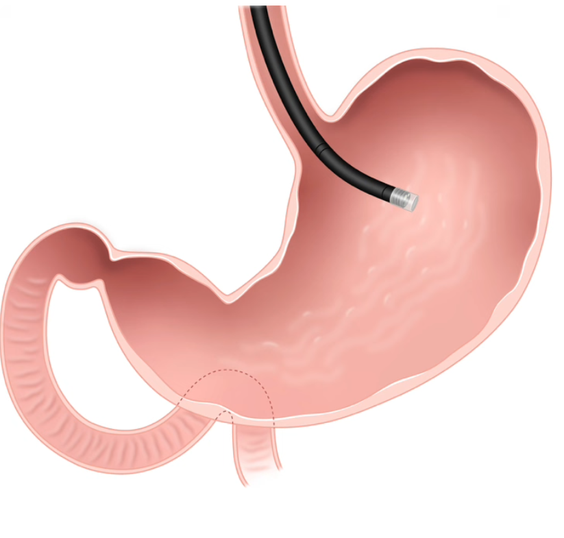 منظار المرئ