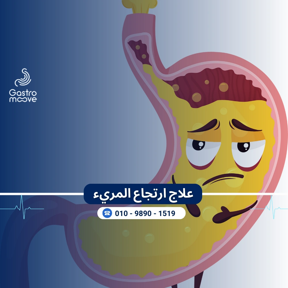 علاج ارتجاع المريء