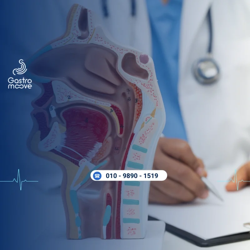 عملية ربط دوالي المري