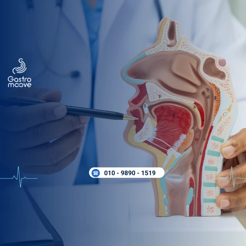 ما هي دوالي المريء ولماذا تحدث