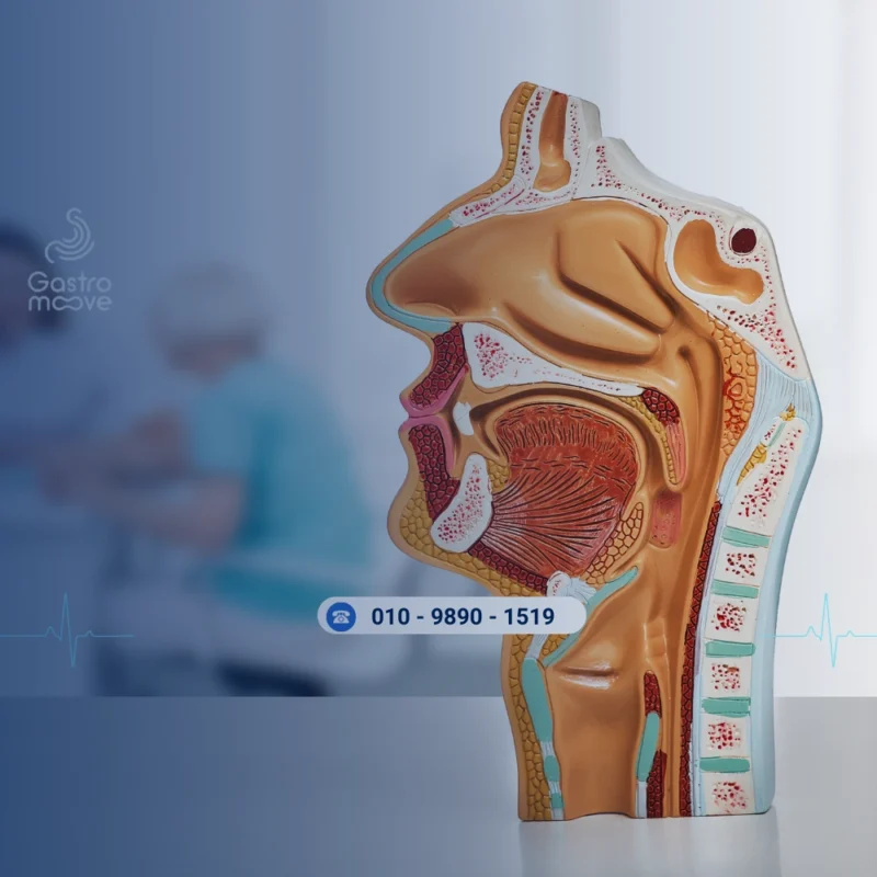 ربط دوالي المريء بالمنظار