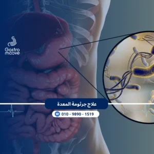 علاج جرثومة المعدة