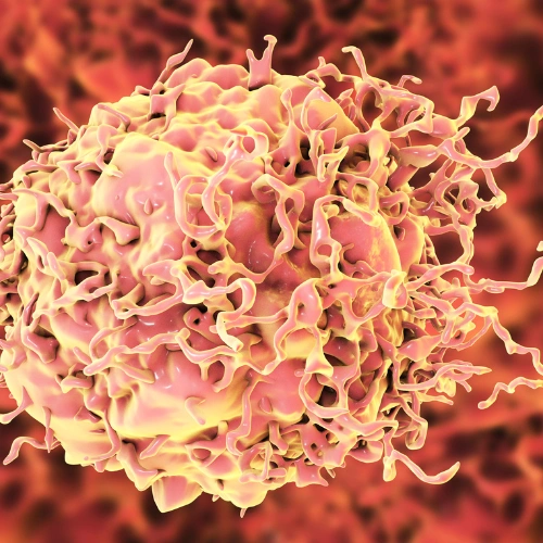 التهاب القولون البكتيري