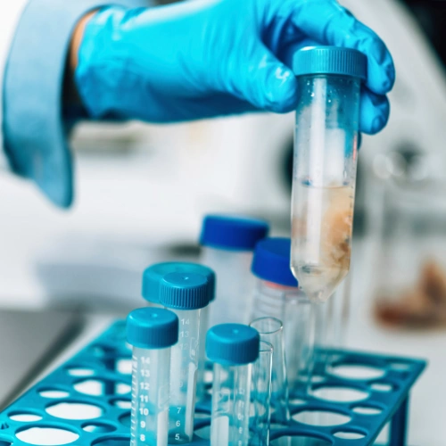 العلاج البيولوجي للقولون التقرحي