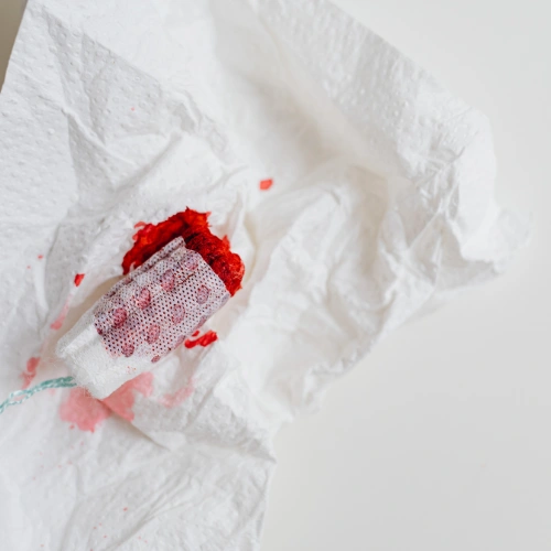 القولون التقرحي خطيرة