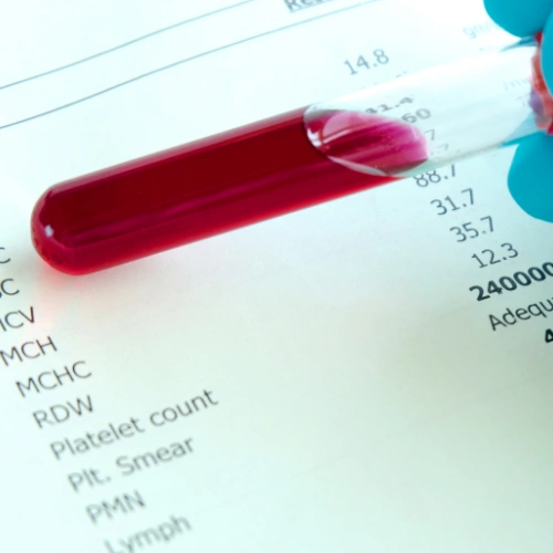 القولون التقرحي عند المريض