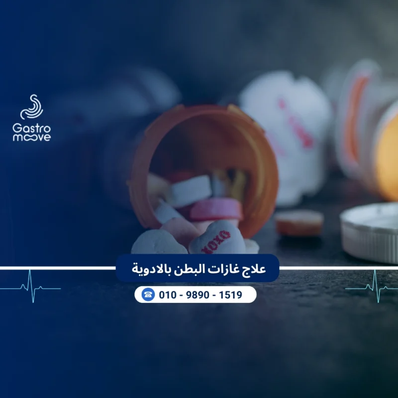 علاج غازات البطن بالادوية