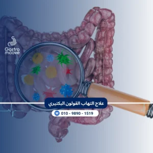 علاج التهاب القولون البكتيري