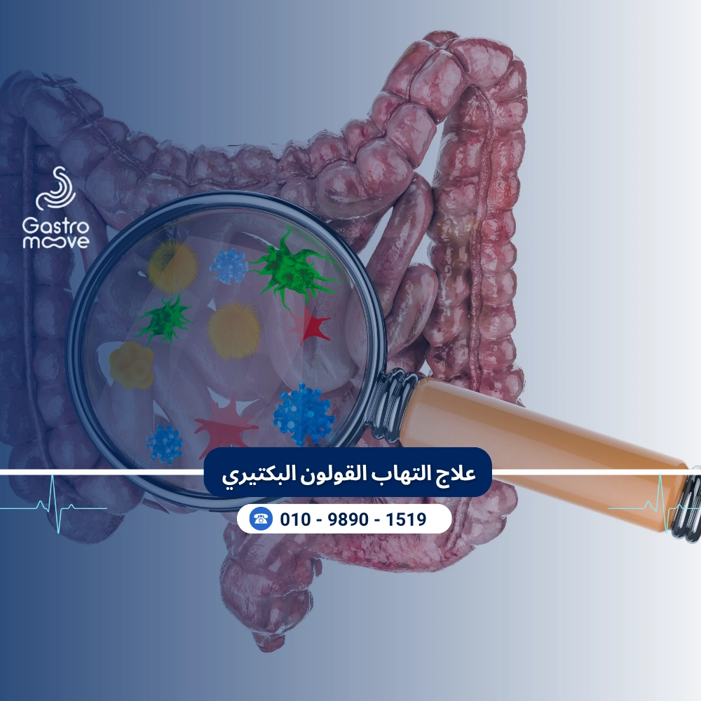 علاج التهاب القولون البكتيري