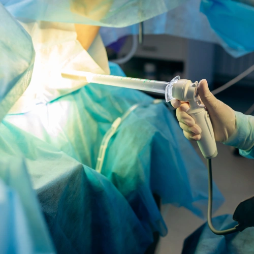 منظار القولون