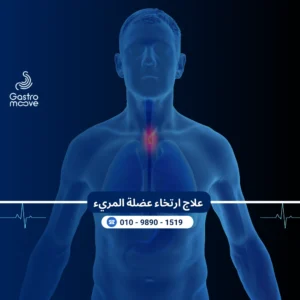 علاج ارتخاء عضلة المريء