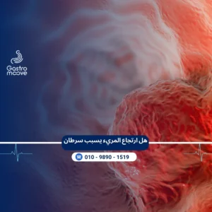 هل ارتجاع المريء يسبب سرطان