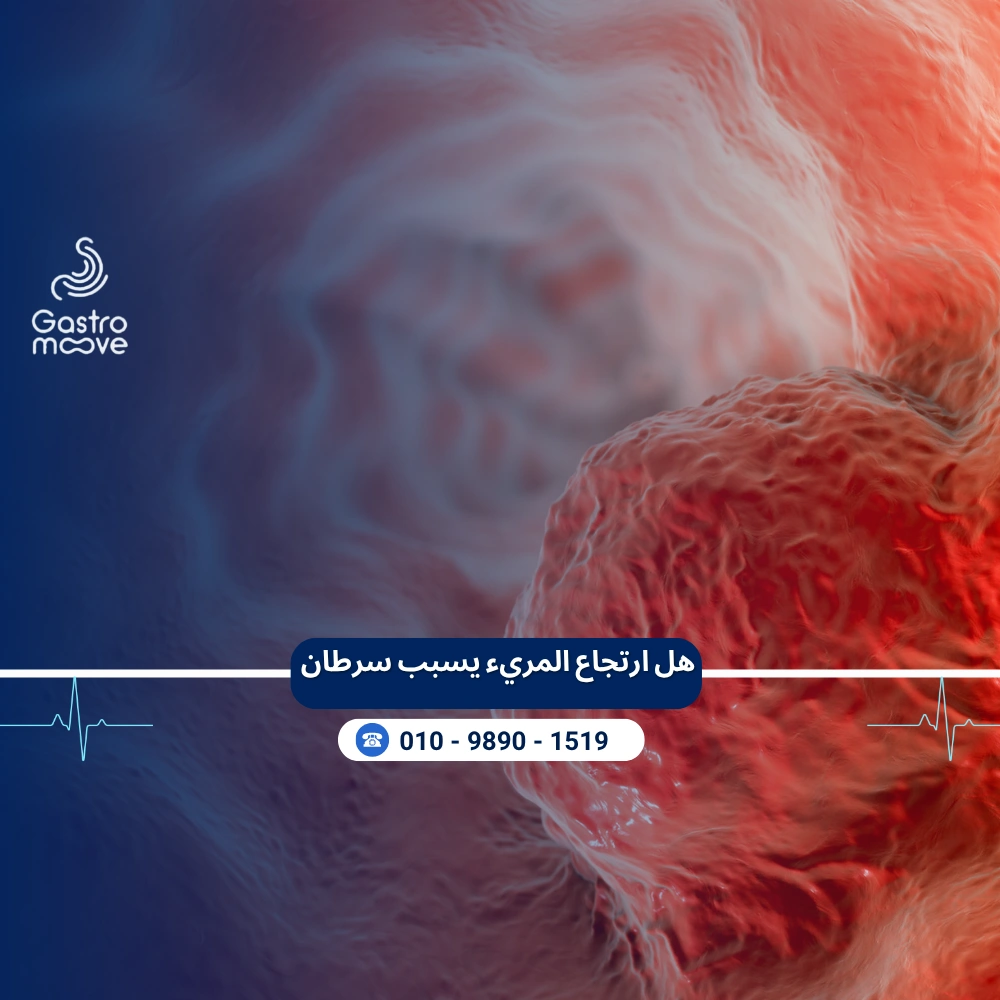 هل ارتجاع المريء يسبب سرطان