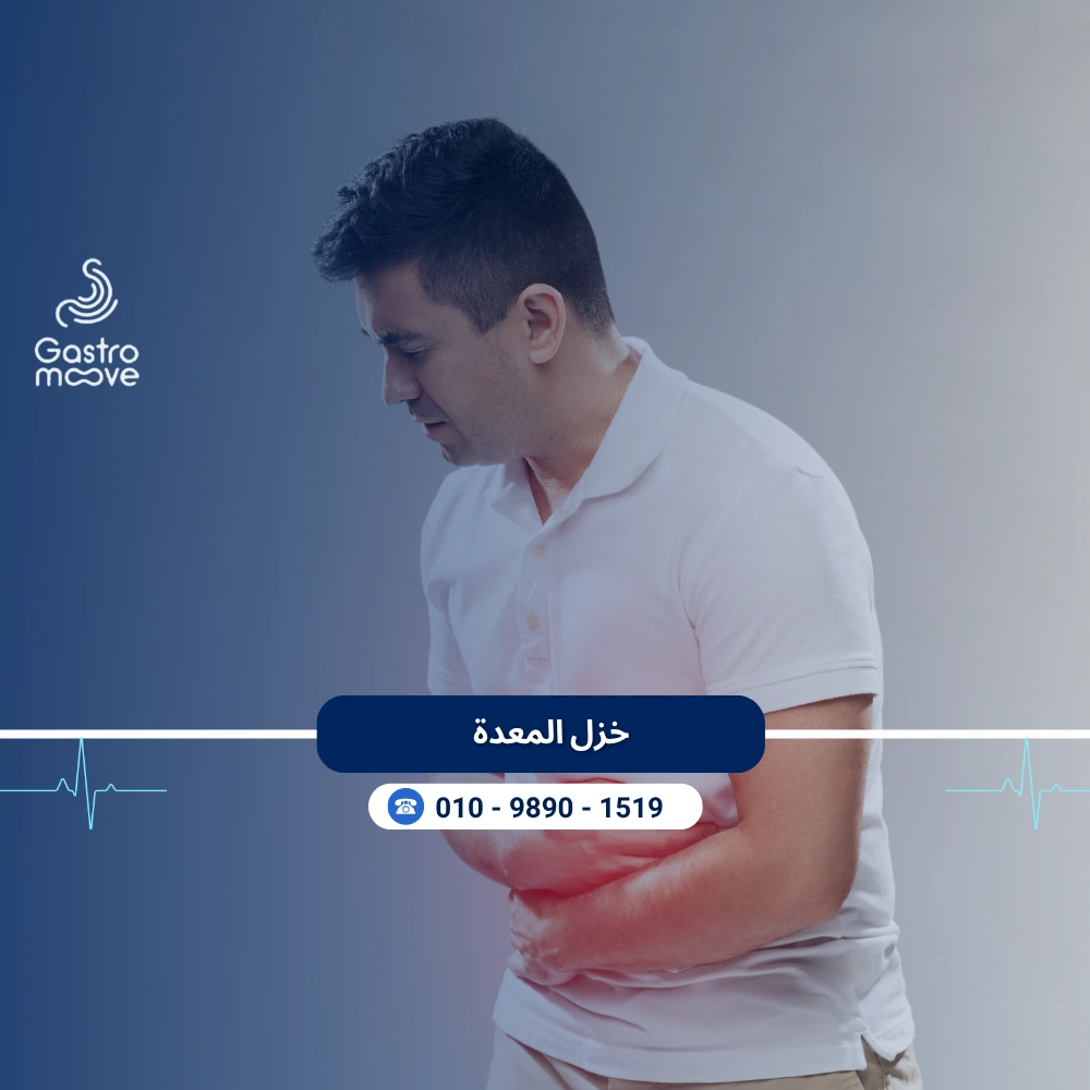 خزل المعدة