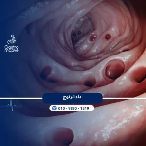 داء الرتوج