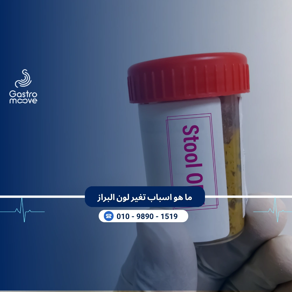 ما هو اسباب تغير لون البراز