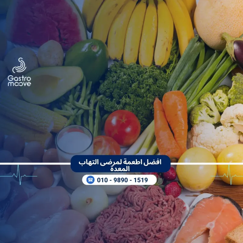 افضل اطعمة لمرضى التهاب المعدة