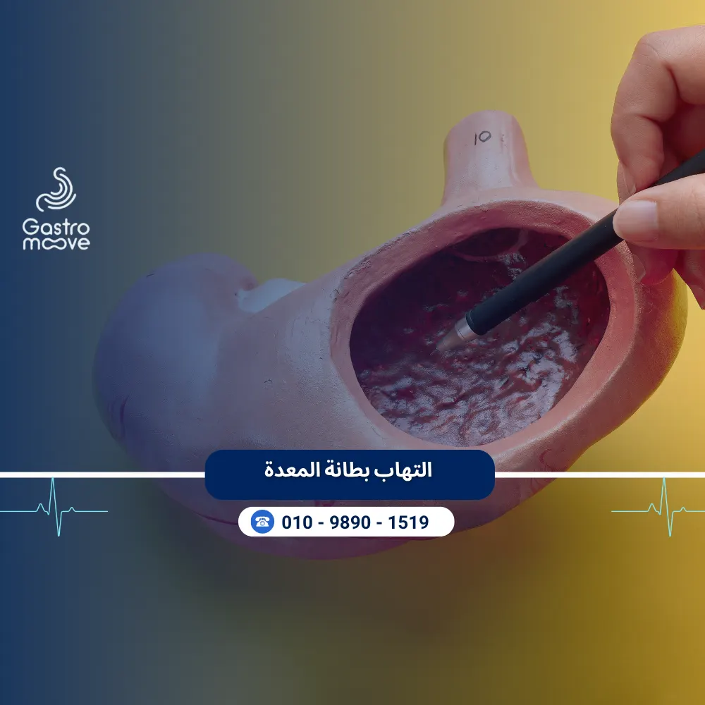 التهاب بطانة المعدة